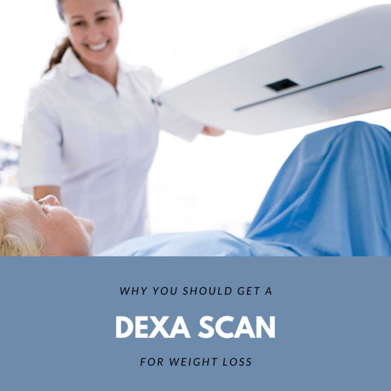 Why You Should Get a DEXA Scan for Weight Loss